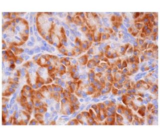 immunohistochemistry image from recommended IL-4Rα (H-4) monoclonal antibody replacement. Image 284772