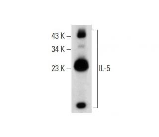 western blotting image from recommended IL-5 (B-2) monoclonal antibody replacement. Image 303801