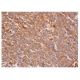 IL-6 Antibody (1) - Immunohistochemistry - Image 352342 