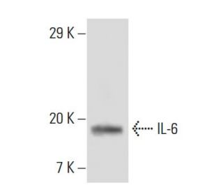 IL-6 Antibody (6D9A1) - Western Blotting - Image 137445