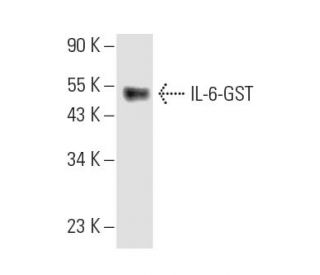 IL-6 Antibody (C12-1-hIL-6) - Western Blotting - Image 8857 