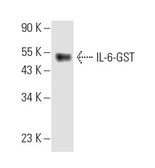 IL 6 Antibody C12 1 hIL 6 SCBT Santa Cruz Biotechnology