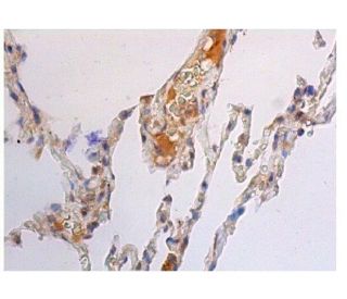 immunohistochemistry image from recommended IL-6 (E-4) monoclonal antibody replacement. Image 352341
