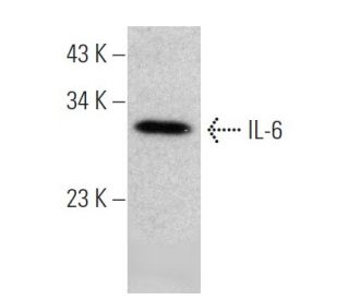 western blotting image from recommended IL-6 (10E5) monoclonal antibody replacement. Image 366614