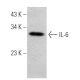 western blotting image from recommended IL-6 (10E5) monoclonal antibody replacement. Image 366614