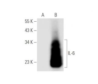 IL-6 (1): sc-130326. Western blot analysis of IL-6 expression in... 