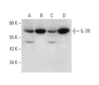 western blotting image from recommended IL-7R (G-11) monoclonal antibody replacement. Image 319277