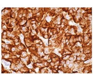 immunohistochemistry image from recommended IL-8RB (E-2) monoclonal antibody replacement. Image 156637