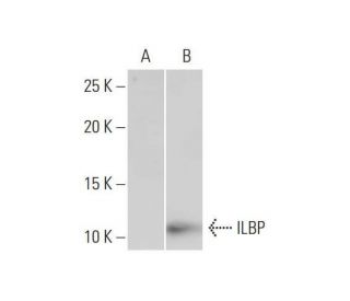 ILBP Antibody (4A4) - Western Blotting - Image 352110 