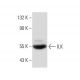ILK Antibody (E-2) - Western Blotting - Image 134709