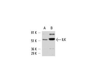 western blotting image from recommended ILK (65.1) monoclonal antibody replacement. Image 6713