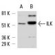 western blotting image from recommended ILK (65.1) monoclonal antibody replacement. Image 6713