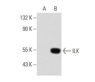 ILK Antibody (65.1) - Western Blotting - Image 134706