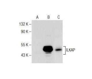 ILKAP Antibody (41) - Western Blotting - Image 281986