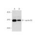 IMD 0354: sc-203084. Western blot analysis of cyclin D3 expression in untreated (A) and IMD 0354 treated (B) MDA-MB-231 wh