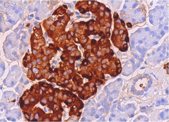 ImmunoCruz goat LSAB Staining System SCBT Santa Cruz