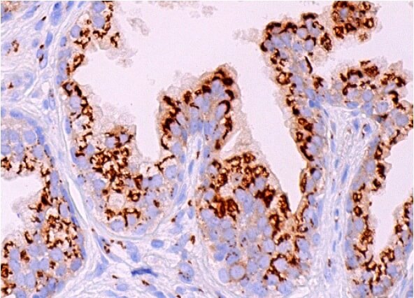 ImmunoCruz goat LSAB Staining System SCBT Santa Cruz