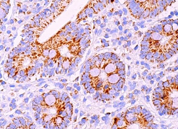 ImmunoCruz goat LSAB Staining System SCBT Santa Cruz