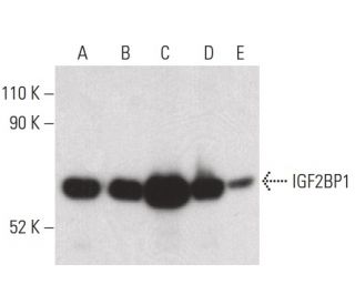 IMP-1/IGF2BP1 Antibody (D-9) - Western Blotting - Image 400367