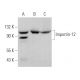 Importin-12 Antibody (C-2) - Western Blotting - Image 369868 