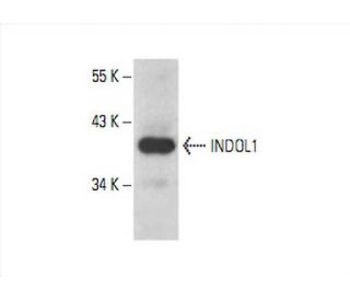 INDOL1 Antibody (C-9) - Western Blotting - Image 392851SAM Transcription Activation: SAM system utilizing dCas9-VP64, MS2-P65-HSF1, and sgRNA for precise gene transcription activation. 