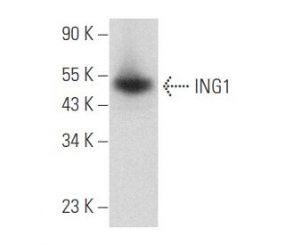 western blotting image from recommended ING1 (E-10) monoclonal antibody replacement. Image 357751