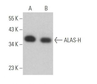 ING2 Antibody (B-5) - Western Blotting - Image 365734