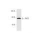 ING3 Antibody (162.1) - Western Blotting - Image 62620 