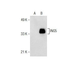 ING5 Antibody (36.85) - Western Blotting - Image 155194 