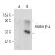 Inhibin β-A Antibody (E-1) - Western Blotting - Image 84024 
