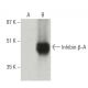 Inhibin β-A Antibody (E-1) - Western Blotting - Image 396497