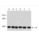 western blotting image from recommended Ini1 (A-5) monoclonal antibody replacement. Image 392961