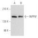 INPP5F Antibody (A-6) - Western Blotting - Image 355458 