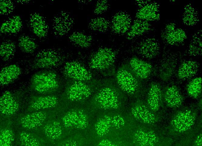 INSM1 Antibody (A-8) | SCBT - Santa Cruz Biotechnology