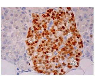 INSM1 Antibody (A-8) | SCBT - Santa Cruz Biotechnology