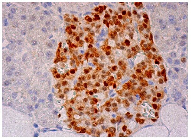 専用 ２点 INSM1 Antibody (A-8) | SCBT - Santa Cruz Biotechnology