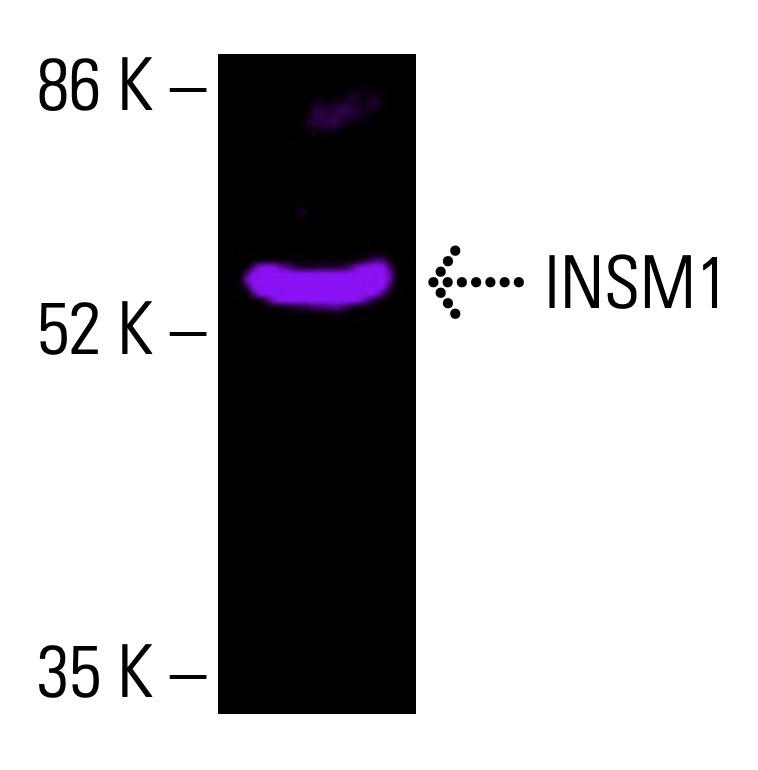 INSM1 Antibody (A-8) | SCBT - Santa Cruz Biotechnology