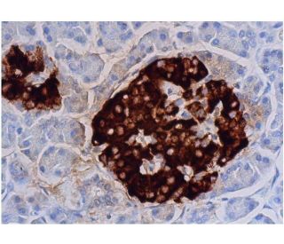 immunohistochemistry image from recommended Insulin (2D11-H5) monoclonal antibody replacement. Image 353016