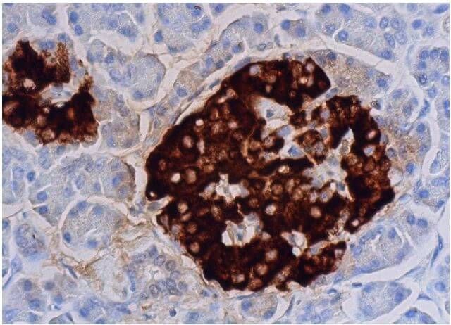 スーパーセール 目玉商品 Insulin Biotechnology Cruz Santa - SCBT | (H-86) Antibody 花束・アレンジメント