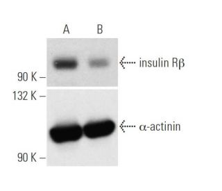 insulin R siRNA (h): sc-29370. Western blot analysis of insulin R&beta; expression in non-transfected control (A) and insu 