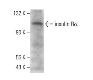 INSR/Insulin Receptor &alpha; Antibody (83-12) - Western Blotting - Image 379083