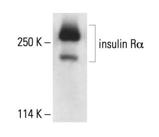 INSR/Insulin Receptor &alpha; Antibody (MA-20) - Western Blotting - Image 411741