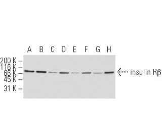 INSR/Insulin Receptor &beta; Antibody (11B6 ) - Western Blotting - Image 62907