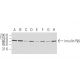 INSR/Insulin Receptor β Antibody (11B6 ) - Western Blotting - Image 62907