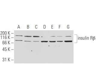 INSR/Insulin Receptor &beta; Antibody (9H4) - Western Blotting - Image 62908