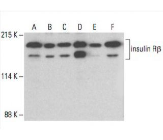 western blotting image from recommended INSR/Insulin Receptor β (CT-3) monoclonal antibody replacement. Image 393025