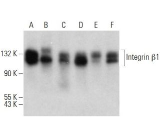 Integrin &beta;1/ITGB1 Antibody (E-11) - Western Blotting - Image 379235The Double Nickase Plasmid features a U6 promoter for sgRNA expression, a 20 nt targeting sequence, and a gRNA scaffold to guide Cas9n. It includes a CBh promoter for Cas9n (D10A) and puromycin resistance, GFP for transfection verification, and nuclear localization signals (NLS). The 2A peptide allows co-expression of Cas9n and Puro from a single promoter, enabling precise genome editing with reduced off-target effects. 