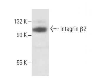 Integrin β2/ITGB2/CD18 Antibody (6G2) - Western Blotting - Image 15484
