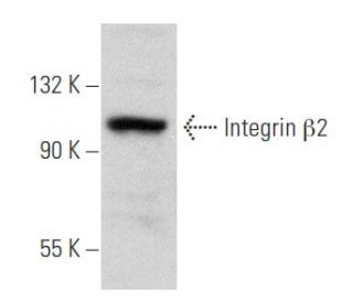 Integrin β2/ITGB2/CD18 Antibody (P4H9) - Western Blotting - Image 354818