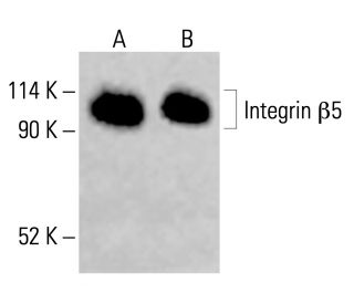 Integrin β5/ITGB5 Antibody (F-5) - Western Blotting - Image 415409